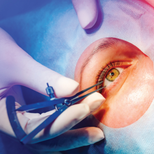 sharpvisioneyehospital best-cornea-treatment-near-me